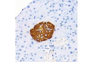 Immunohistochemistry of paraffin-embedded mouse pancreatic islet using Insulin Rabbit mAb (ABIN7267886) at dilution of 1:100 (40x lens).