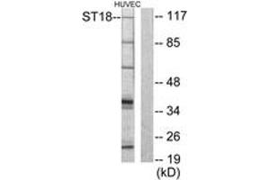 Western blot analysis of extracts from HuvEc cells, using ZNF387 Antibody. (ST18 anticorps  (AA 41-90))