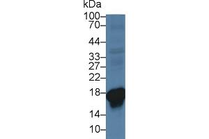Detection of SOD1 in Porcine Liver lysate using Polyclonal Antibody to Superoxide Dismutase 1 (SOD1) (SOD1 anticorps  (AA 2-153))