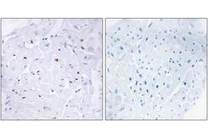 Immunohistochemistry analysis of paraffin-embedded human heart, using Smad3 (Phospho-Thr179) Antibody.