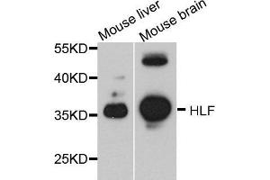 Western blot analysis of extracts of various cell lines, using HLF antibody. (HLF anticorps  (AA 1-295))