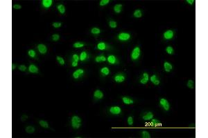 Immunofluorescence of monoclonal antibody to TCF7L2 on HeLa cell. (TCF7L2 anticorps  (AA 490-596))
