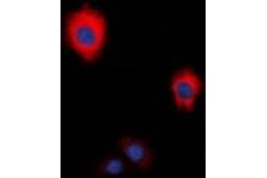Immunofluorescent analysis of ZAP70 staining in HeLa cells. (ZAP70 anticorps  (C-Term))