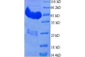 SDS-PAGE (SDS) image for Cytochrome P450, Family 21, Subfamily A, Polypeptide 2 (CYP21A2) (AA 2-261) protein (His-SUMO Tag) (ABIN5709173)
