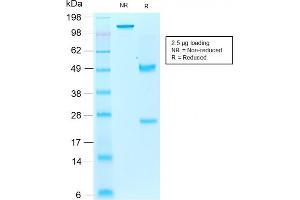 SDS-PAGE Analysis Purified AIF1 / Iba1 Mouse Recombinant Monoclonal Antibody (rAIF1/1909).