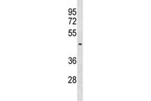 SUV39H2 antibody western blot analysis in MDA-MB453 lysate.