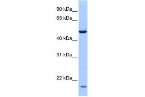 ZNF764 antibody used at 0. (ZNF764 anticorps  (N-Term))