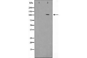 Western blot analysis on HeLa cell lysate using HSP105 Antibody,The lane on the left is treated with the antigen-specific peptide. (HSPH1 anticorps  (C-Term))