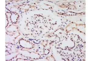 Formalin-fixed and paraffin embedded human kidney labeled with Anti-Bcl-2 Polyclonal Antibody, Unconjugated  at 1:200 followed by conjugation to the secondary antibody and DAB staining. (Bcl-2 anticorps  (AA 51-150))