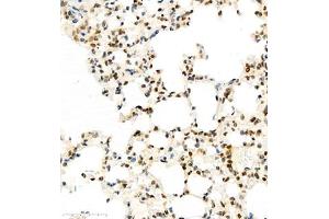 Immunohistochemistry of paraffin embedded mouse lung using HIF-3α (ABIN7074273) at dilution of 1:1600 (400x lens) (HIF3A anticorps)