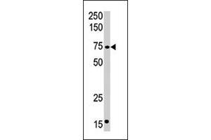 Western blot analysis of CPT2 polyclonal antibody  in mouse kidney tissue lysate (35 ug/lane). (CPT2 anticorps  (C-Term))