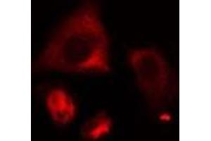 ABIN6274999 staining HeLa cells by IF/ICC. (CLN6 anticorps  (Internal Region))