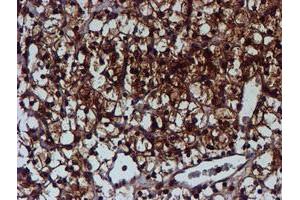 Image no. 4 for anti-Chromosome 1 Open Reading Frame 50 (C1ORF50) antibody (ABIN1497033)