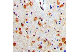 Immunohistochemical analysis of Beta-arrestin-1 staining in human brain formalin fixed paraffin embedded tissue section.
