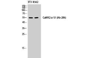 Western Blotting (WB) image for anti-CaMKIIalpha/delta (Lys542) antibody (ABIN3183638) (CaMKIIalpha/delta anticorps  (Lys542))