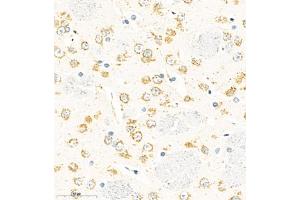 Immunohistochemistry of paraffin embedded rat brain using TMEM176A (ABIN7075995) at dilution of 1:500 (400x lens) (TMEM176A anticorps)