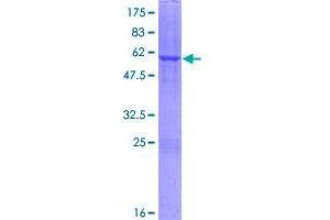 Image no. 1 for Dehydrogenase/reductase (SDR Family) Member 1 (DHRS1) (AA 1-313) protein (GST tag) (ABIN1351547)