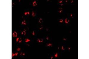 Immunofluorescence of PUMA in K562 cells with PUMA antibody at 10 ug/ml (PUMA anticorps  (N-Term))