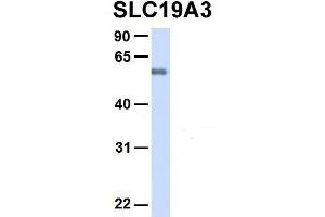 Host:  Rabbit  Target Name:  SLC19A3  Sample Type:  Human Fetal Heart  Antibody Dilution:  1.