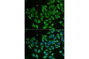 Immunofluorescence analysis of HeLa cell using CLEC3B antibody. (CLEC3B anticorps)