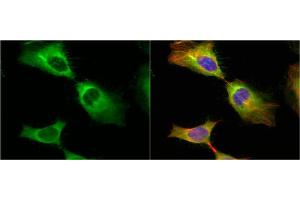 ICC/IF Image HSP27 antibody detects HSP27 protein at cytoplasm and cytoskeleton by immunofluorescent analysis.