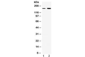 Western blot testing of 1) rat liver and 2) COLO320 lysate with CSB antibody at 0. (ERCC6 anticorps  (AA 160-205))