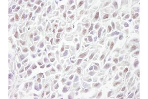 Immunohistochemistry (IHC) image for anti-Structural Maintenance of Chromosomes 3 (SMC3) (C-Term) antibody (ABIN7448804) (SMC3 anticorps  (C-Term))