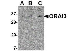 Western Blotting (WB) image for anti-ORAI Calcium Release-Activated Calcium Modulator 3 (ORAI3) (N-Term) antibody (ABIN2475965) (ORAI3 anticorps  (N-Term))