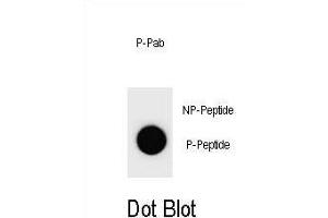Dot blot analysis of Mouse CCNB3 Antibody (Phospho ) Phospho-specific Pab (ABIN1881168 and ABIN2839968) on nitrocellulose membrane. (Cyclin B3 anticorps  (pSer1063))