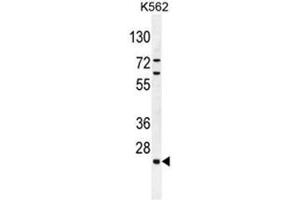C15orf41 Antibody (Center) western blot analysis in K562 cell line lysates (35µg/lane). (BC052040 anticorps  (Middle Region))