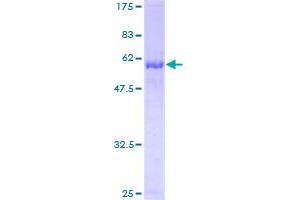 Image no. 1 for Methylthioribose-1-Phosphate Isomerase 1 (Mri1) (AA 1-369) protein (GST tag) (ABIN1310849)