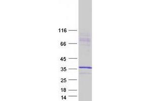 Validation with Western Blot