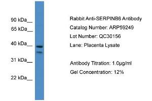 WB Suggested Anti-SERPINB6  Antibody Titration: 0. (SERPINB6 anticorps  (Middle Region))