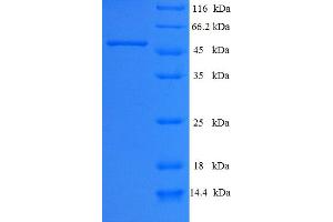 SDS-PAGE (SDS) image for Aminoadipate-Semialdehyde Dehydrogenase-phosphopantetheinyl Transferase (AASDHPPT) (AA 1-309), (full length) protein (His-SUMO Tag) (ABIN5711789)