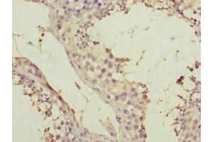 Immunohistochemistry of paraffin-embedded human testis tissue using ABIN7170586 at dilution of 1:100 (SPICE1 anticorps  (AA 1-220))