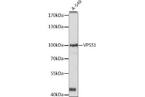 Western blot analysis of extracts of A-549 cells, using VPS51 antibody (ABIN7271280) at 1:1000 dilution.