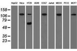 Western blot analysis of extracts (35 µg) from 9 different cell lines by using anti-SIGLEC9 monoclonal antibody. (SIGLEC9 anticorps)