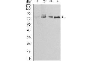 Western Blotting (WB) image for anti-Ezrin (EZR) (AA 292-464) antibody (ABIN5886560) (Ezrin anticorps  (AA 292-464))