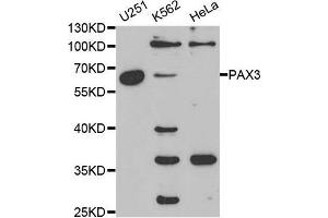 Western blot analysis of extracts of various cell lines, using PAX3 antibody. (Paired Box 3 anticorps  (AA 1-206))