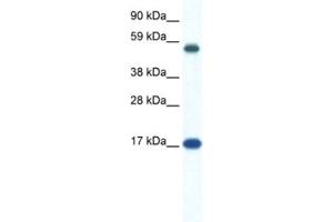 Western Blotting (WB) image for anti-Zinc Finger Protein 554 (ZNF554) antibody (ABIN2461304) (ZNF554 anticorps)