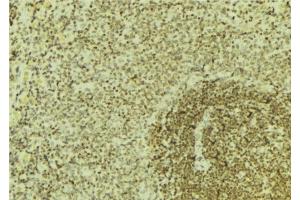 ABIN6276675 at 1/100 staining Mouse pancreas tissue by IHC-P. (CBS anticorps  (Internal Region))