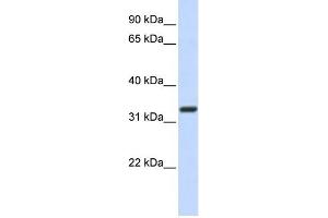 WB Suggested Anti-Nkx2-5 Antibody Titration: 0. (NK2 Homeobox 5 anticorps  (N-Term))