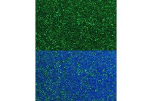 Immunofluorescence analysis of mouse thymus cells using PM antibody (ABIN6134400, ABIN6145810, ABIN6145811 and ABIN6225100) at dilution of 1:100. (NOXA anticorps  (AA 1-54))