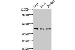 Western Blot Positive WB detected in: Raji whole cell lysate, Hela whole cell lysate, Jurkat whole cell lysate All lanes: Pregnancy-associated glycoprotein 1 antibody at 3 μg/mL Secondary Goat polyclonal to rabbit IgG at 1/50000 dilution Predicted band size: 43 kDa Observed band size: 43 kDa (PAG1 anticorps  (AA 54-380))