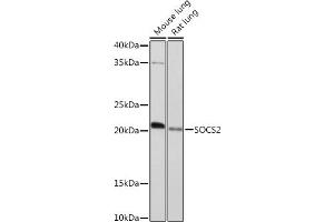 Western blot analysis of extracts of various cell lines, using SOCS2 Rabbit mAb (ABIN7270641) at 1:1000 dilution. (SOCS2 anticorps)