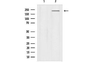 Western blot analysis of lysates from Mouse lung, using Nav1.
