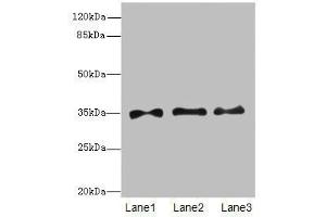 Western blot All lanes: PRPS1antibody at 6. (PRPS1 anticorps  (AA 1-318))