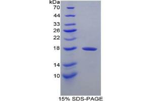 SDS-PAGE analysis of Dog Transthyretin Protein. (TTR Protéine)
