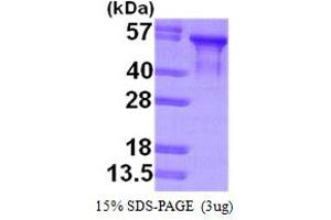 SDS-PAGE (SDS) image for Microtubule-Associated Protein tau (MAPT) (AA 1-381) protein (His tag) (ABIN667844)