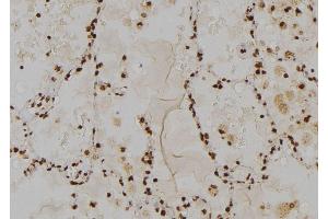 ABIN6275900 at 1/100 staining Human lung tissue by IHC-P. (TOLLIP anticorps  (Internal Region))